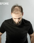 200 ml Mane Hair Thickener and Seal & Control with a Shampoo, Conditioner and Hairline Enhancer