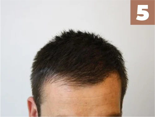 Step Five